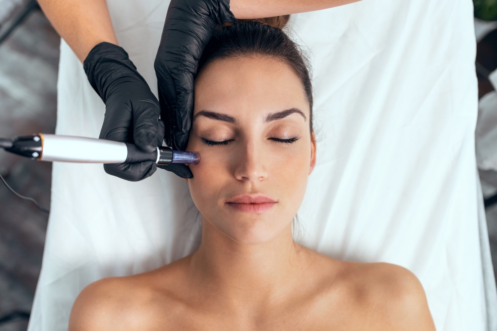 Microneedling at Luxxe Wellness & Beauty in San Antonio, TX